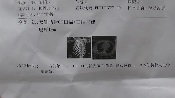 摔斷四根肋骨！那一刻，他得多疼啊……