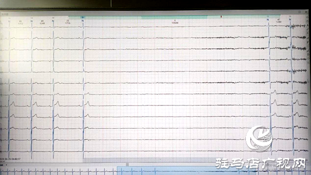 40歲中年 一夜之間心臟停搏30次最長(zhǎng)10秒鐘 該拿什么拯救他?